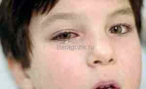 Альбуцид детям 2 года в глаза