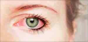 Какие капли для глаз лучше альбуцид или левомицетин