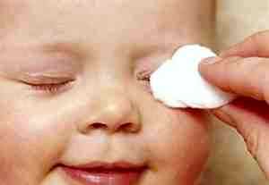 Альбуцид глазные для детей до года