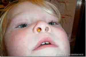 Альбуцид в нос детям 4 месяца