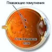 Альбуцид капли для глаз для детей инструкция по применению