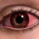 Альбуцид капли глазные от покраснения глаз