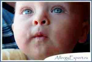 Аллергия на альбуцид у грудничка