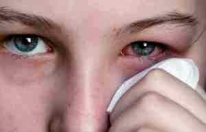 Альбуцид глазные капли для детей 2