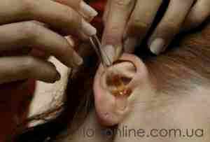 Альбуцид сульфацил натрия в ухо