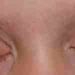 Альбуцид капли для глаз для детей