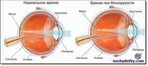 Альбуцид для глаз ребенку 1 год