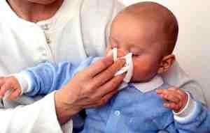 Лечение насморка у новорожденных альбуцид