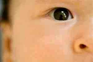 Альбуцид для детей 3 месяца в глаза
