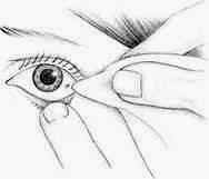 Альбуцид это сульфацил натрия в глаза