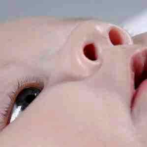 У младенца гноятся глазки альбуцид