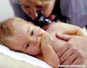 Альбуцид при насморке у грудных детей
