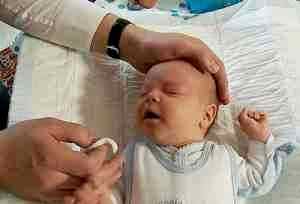 Сколько капать альбуцид в глаза ребенку