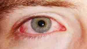 Альбуцид глазные капли в нос для детей