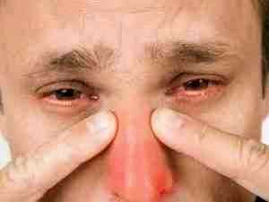 Альбуцид в нос или полидекса