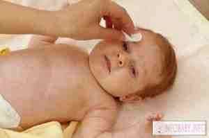 Как долго можно капать альбуцид новорожденному