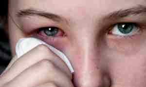 Рецепт альбуцида в каплях для глаз
