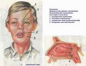 Альбуцид в нос при аденоидите