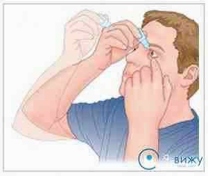 Как правильно закапывать глаза альбуцидом