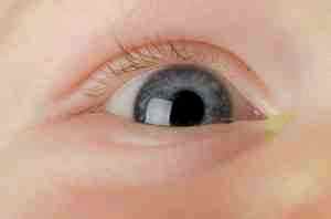 Как часто капать альбуцид ребенку в глаза