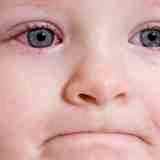 Капли альбуцид в глаза ребенку
